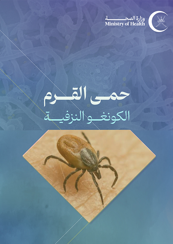 حمى القرم النزفية